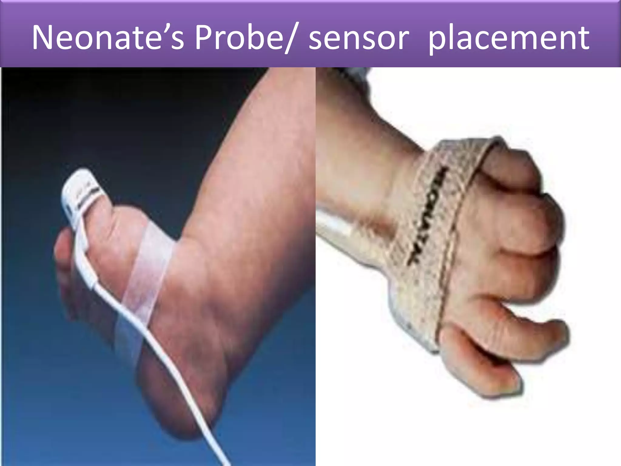Neonate’s Probe/ sensor placement

 