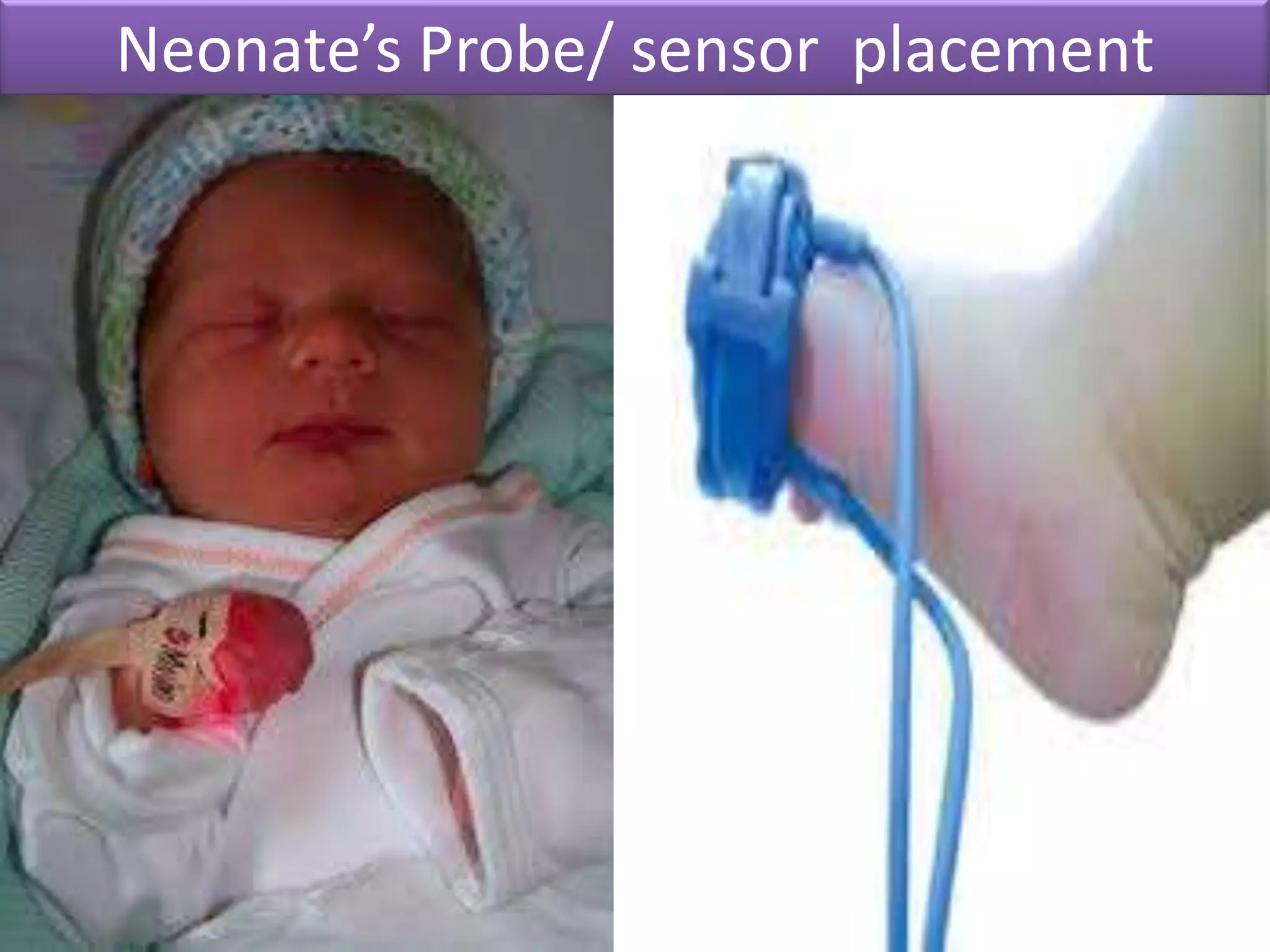 Neonate’s Probe/ sensor placement

 