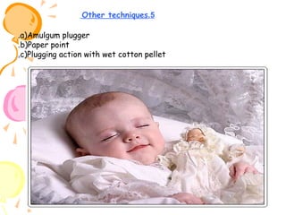 Other techniques.5
.a)Amulgum plugger
.b)Paper point
.c)Plugging action with wet cotton pellet

 