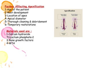 Factors Affecting Apexification
1-Age of the patient
2-Root development
3-Location of apex
4-Apical diameter
5-Thorough cleaning & debridement
6-Temporary restorations
Materials used are :
1-Calcium hydroxide
Tricaclium phosphate-2
3-Bone growth factors
4-MTA

 