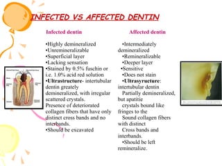 INFECTED VS AFFECTED DENTIN
Infected dentin
▪Highly demineralized
▪Unremineralizable
▪Superficial layer
▪Lacking sensation
▪Stained by 0.5% fuschin or
i.e. 1.0% acid red solution
▪Ultrastructure- intertubular
dentin greately
demineralized, with irregular
scattered crystals.
Presence of deteriorated
collagen fibers that have only
distinct cross bands and no
interbands.
▪Should be excavated

Affected dentin
▪Intermediately
demineralized
▪Remineralizable
▪Deeper layer
▪Sensitive
▪Does not stain
▪Ultrasyructure:
intertubular dentin
Partially demineralized,
but apatitie
crystals bound like
fringes to the
Sound collagen fibers
with distinct
Cross bands and
interbands.
▪Should be left
remineralize.

 