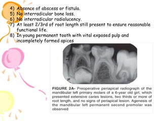 4)
5)
6)
7)

Absence of abscess or fistula.
No interradicular bone loss.
No interradicular radiolucency.
At least 2/3rd of root length still present to ensure reasonable
functional life.
8) In young permanent tooth with vital exposed pulp and
incompletely formed apices

 