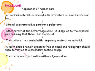 PROCEDURE:

Application of rubber dam
↓
All carious material is removed with excavators or slow speed round
bur.
↓
Coronal pulp removed,to perform a pulpotomy.
↓
After arrest of the hemorrhage,Ca(OH)2 is applied to the exposed
pulp,ensuring that there is no blood clot.
↓
The cavity is then sealed with temporary restorative material.
A tooth should remain symptom free at recall and radiograph should
show formation of a secondary dentine bridge.
↓
Then permanent restoration with amalgam is done.

 