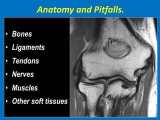 Anatomy and Pitfalls.
 