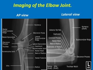 Imaging of the Elbow Joint.
AP view Lateral view
 