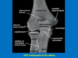(AP) radiograph of the elbow.
 