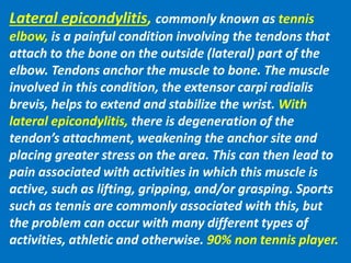 Lateral epicondylitis, commonly known as tennis
elbow, is a painful condition involving the tendons that
attach to the bone on the outside (lateral) part of the
elbow. Tendons anchor the muscle to bone. The muscle
involved in this condition, the extensor carpi radialis
brevis, helps to extend and stabilize the wrist. With
lateral epicondylitis, there is degeneration of the
tendon’s attachment, weakening the anchor site and
placing greater stress on the area. This can then lead to
pain associated with activities in which this muscle is
active, such as lifting, gripping, and/or grasping. Sports
such as tennis are commonly associated with this, but
the problem can occur with many different types of
activities, athletic and otherwise. 90% non tennis player.
 