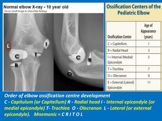 Order of elbow ossification centre development
C - Capitulum (or Capitellum) R - Radial head I - Internal epicondyle (or
medial epicondyle) T- Trochlea O - Olecranon L - Lateral (or external
epicondyle). Mnemonic = C R I T O L
 