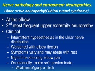 Nerve pathology and entrapment Neuropathies.
Ulnar nerve neuropathy(Cubital tunnel syndrome).
 