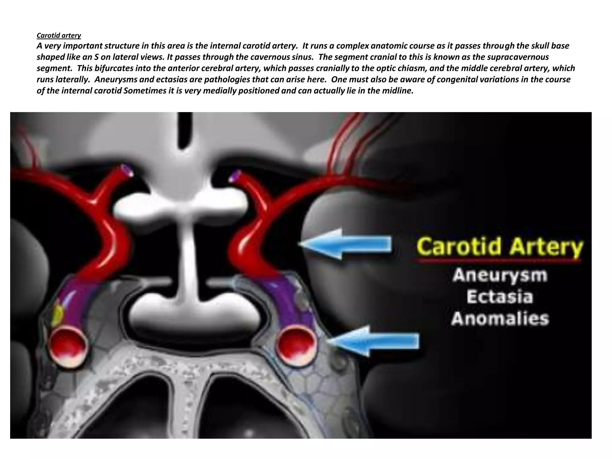 Carotid artery

A very important structure in this area is the internal carotid artery. It runs a complex anatomic course as it passes through the skull base
shaped like an S on lateral views. It passes through the cavernous sinus. The segment cranial to this is known as the supracavernous
segment. This bifurcates into the anterior cerebral artery, which passes cranially to the optic chiasm, and the middle cerebral artery, which
runs laterally. Aneurysms and ectasias are pathologies that can arise here. One must also be aware of congenital variations in the course
of the internal carotid Sometimes it is very medially positioned and can actually lie in the midline.

 