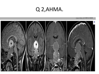 Q 2,AHMA.

 