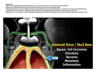 Sphenoid sinus

Inferior to the pituitary gland lies the sphenoid sinus. This structure contains air and is lined by mucosa and bone.
Posterior to the sphenoid sinus lies the clivus (not shown on this coronal section through the brain).
Pathology that arises in this area includes carcinomas arising from the mucosa of the sphenoid sinus - squamous cell carcinoma and adenoid cystic
carcinoma are the most common. Chordomas arise in the clivus and chondrosarcomas and osteosarcomas also occur in this area.
Metastases can occur anywhere. Bacterial or fungal inflammatory processes in the sphenoid sinus can spread Intracranially via the cavernous sinus.

 
