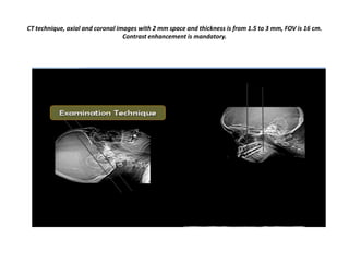 CT technique, axial and coronal images with 2 mm space and thickness is from 1.5 to 3 mm, FOV is 16 cm.
Contrast enhancement is mandatory.

 