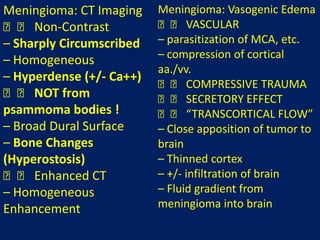 Meningioma: CT Imaging
􀂄􀂄 Non-Contrast
– Sharply Circumscribed
– Homogeneous
– Hyperdense (+/- Ca++)
􀂄􀂄 NOT from
psammoma bodies !
– Broad Dural Surface
– Bone Changes
(Hyperostosis)
􀂄􀂄 Enhanced CT
– Homogeneous
Enhancement

Meningioma: Vasogenic Edema
􀂄􀂄 VASCULAR
– parasitization of MCA, etc.
– compression of cortical
aa./vv.
􀂄􀂄 COMPRESSIVE TRAUMA
􀂄􀂄 SECRETORY EFFECT
􀂄􀂄 “TRANSCORTICAL FLOW”
– Close apposition of tumor to
brain
– Thinned cortex
– +/- infiltration of brain
– Fluid gradient from
meningioma into brain

 