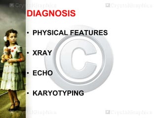 DIAGNOSIS
• PHYSICAL FEATURES
• XRAY
• ECHO

• KARYOTYPING

 