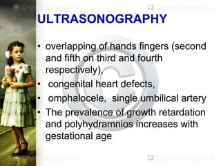 ULTRASONOGRAPHY
• overlapping of hands fingers (second
and fifth on third and fourth
respectively),
• congenital heart defects,
• omphalocele, single umbilical artery
• The prevalence of growth retardation
and polyhydramnios increases with
gestational age

 
