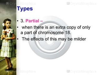 Types
• 3. Partial –
• when there is an extra copy of only
a part of chromosome 18.
• The effects of this may be milder

 