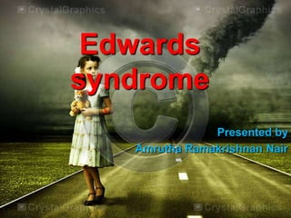 Edwards
syndrome
Presented by
Amrutha Ramakrishnan Nair

 