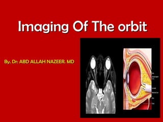 Imaging Of The orbit
By. Dr: ABD ALLAH NAZEER. MD

 
