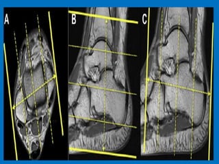 Presentation1.pptx ankle joint.. | PPTX