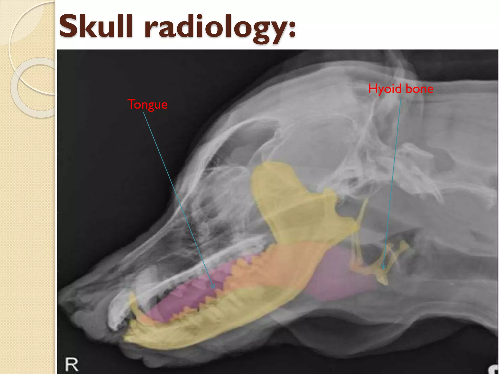 Skull radiology:
Tongue

Hyoid bone

 