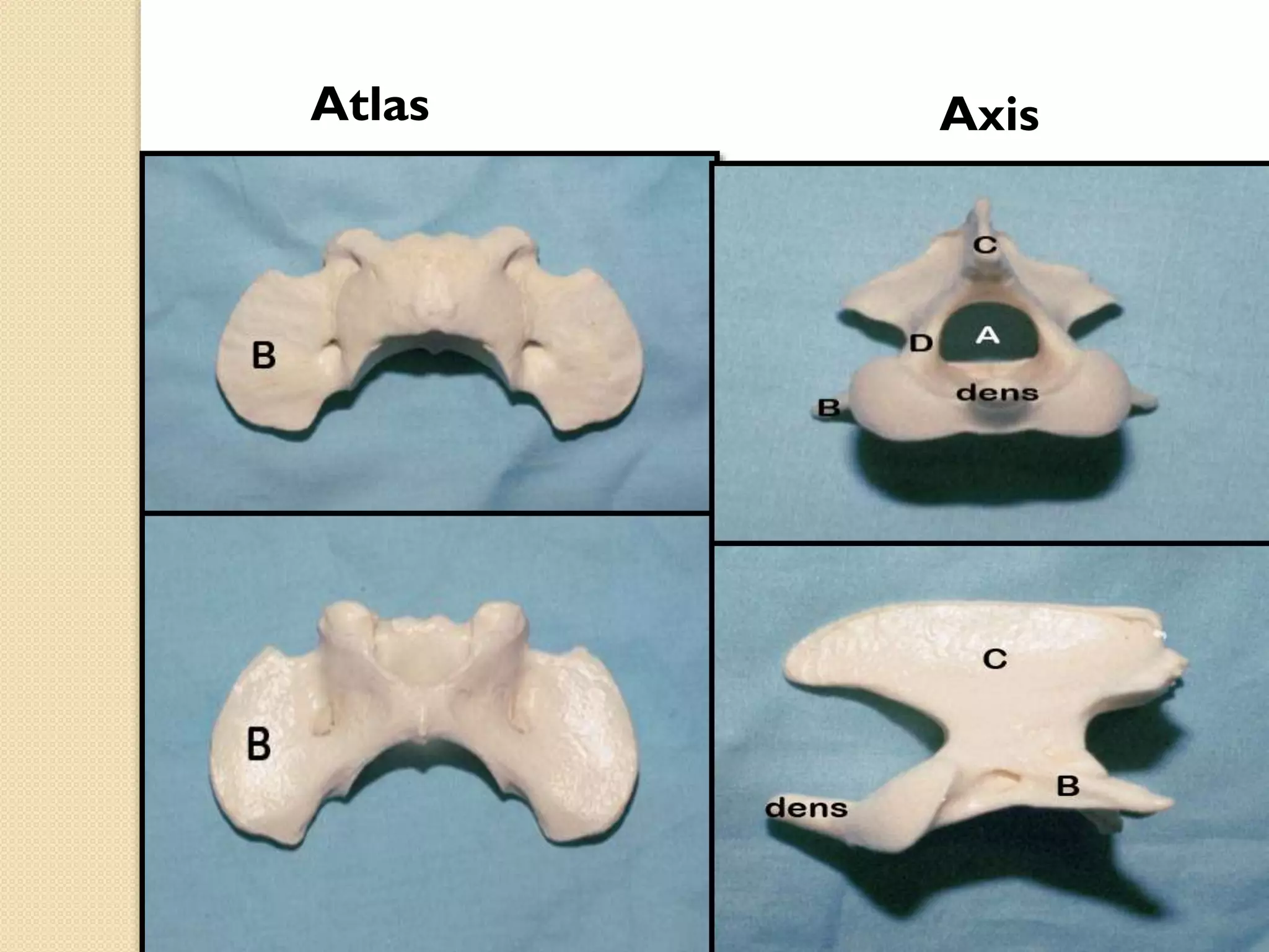 Atlas

Axis

 