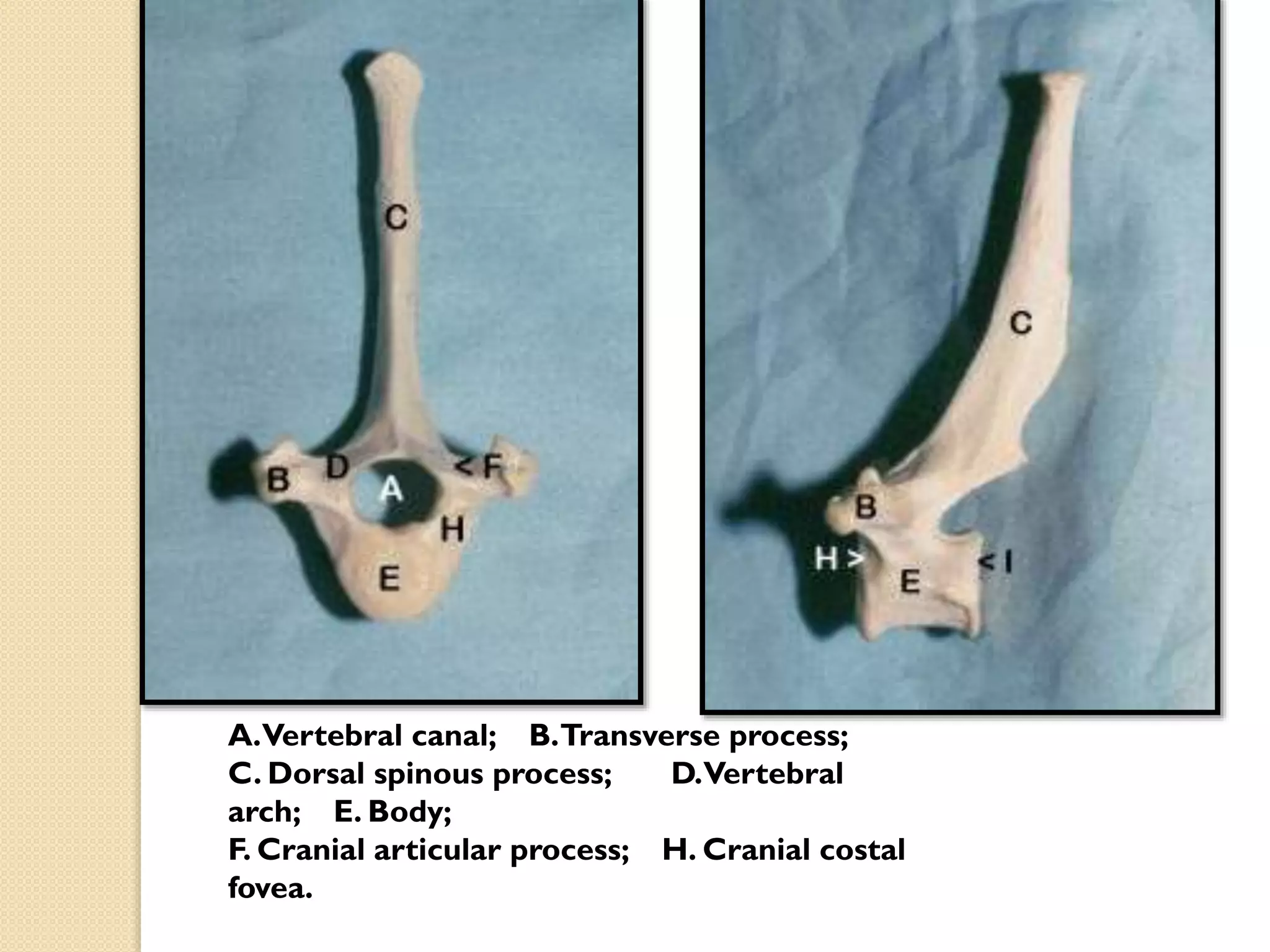 A.Vertebral canal; B.Transverse process;
C. Dorsal spinous process;
D.Vertebral
arch; E. Body;
F. Cranial articular process; H. Cranial costal
fovea.

 