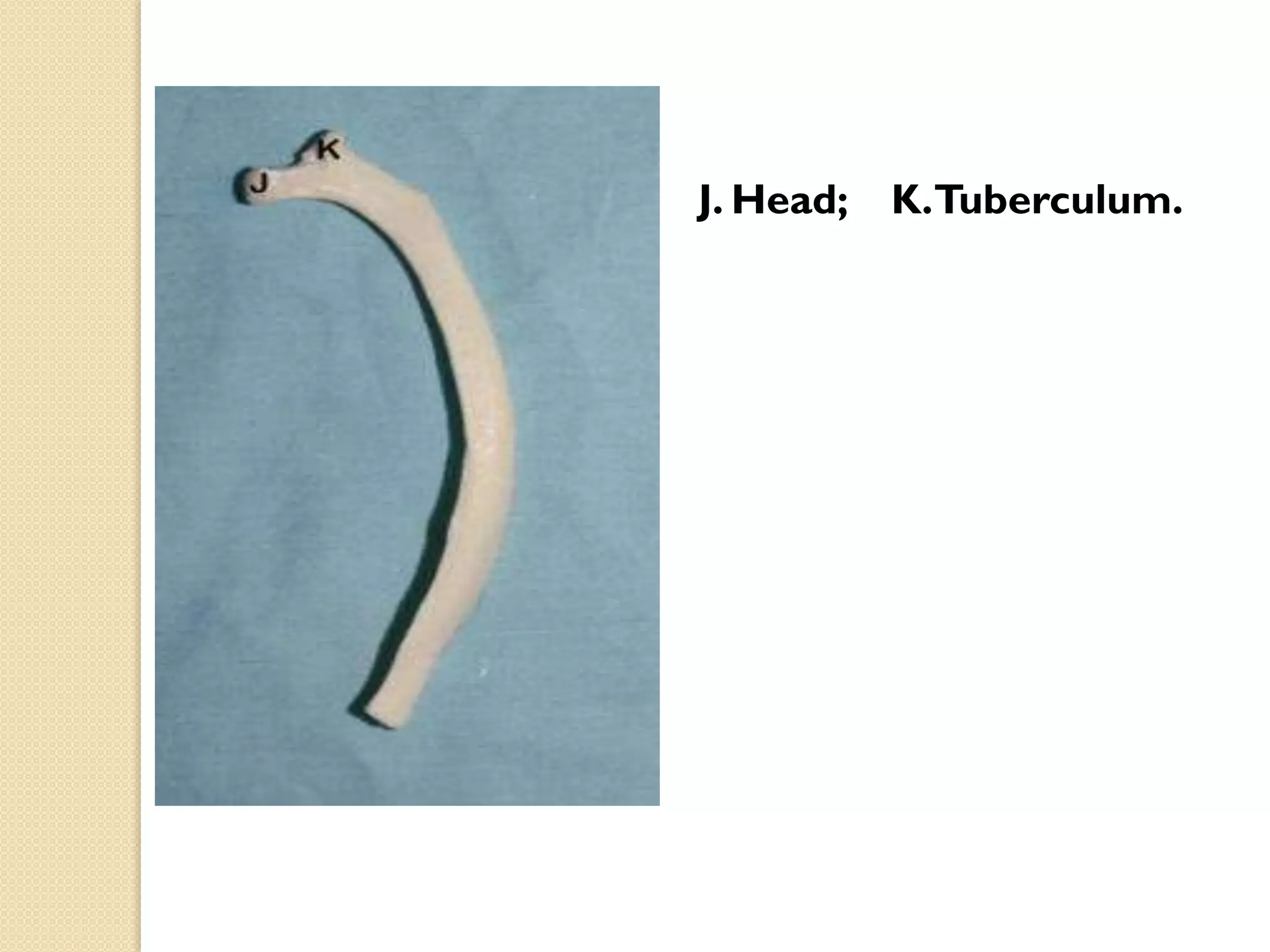 J. Head;

K.Tuberculum.

 