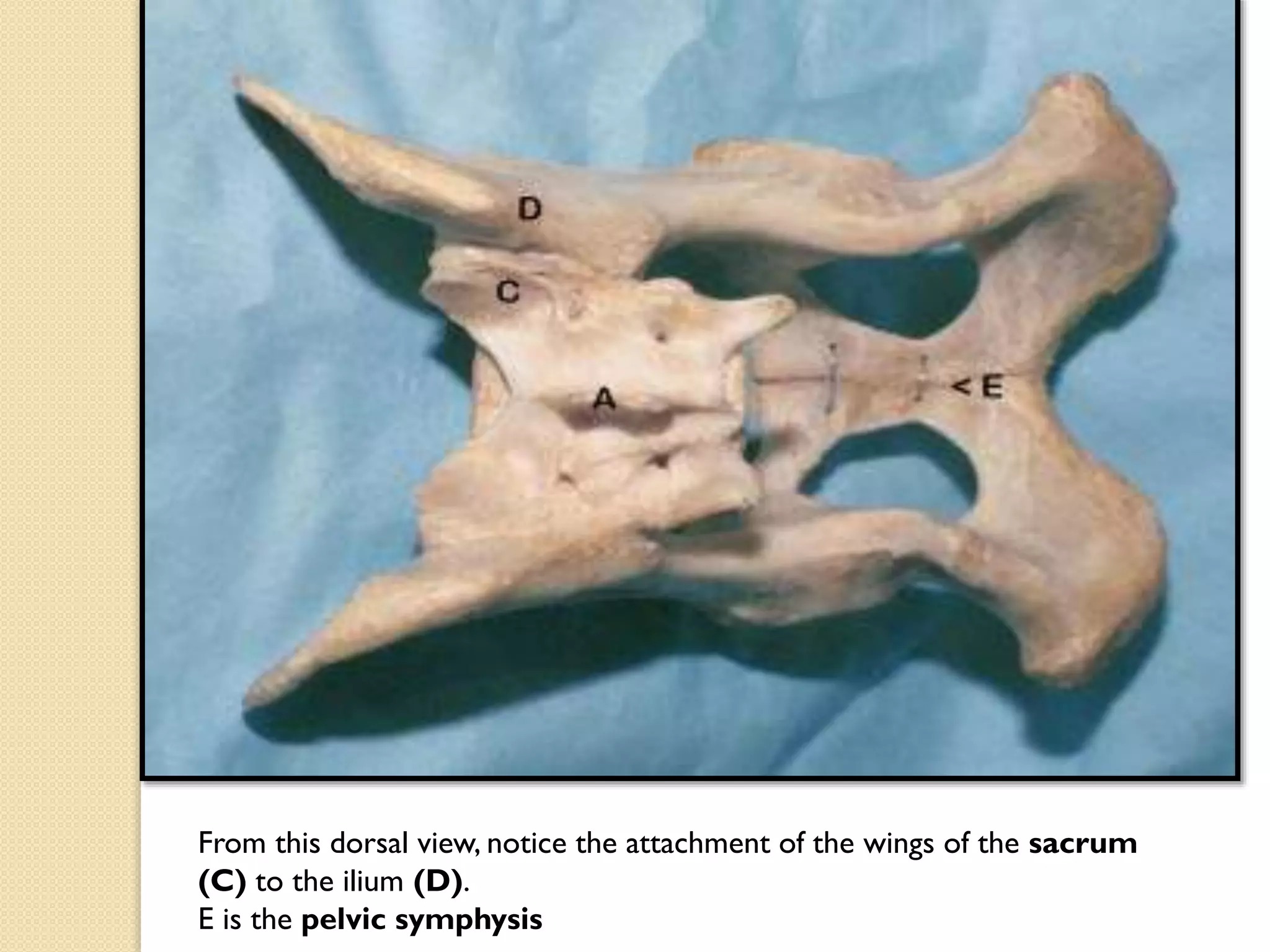 From this dorsal view, notice the attachment of the wings of the sacrum
(C) to the ilium (D).
E is the pelvic symphysis

 