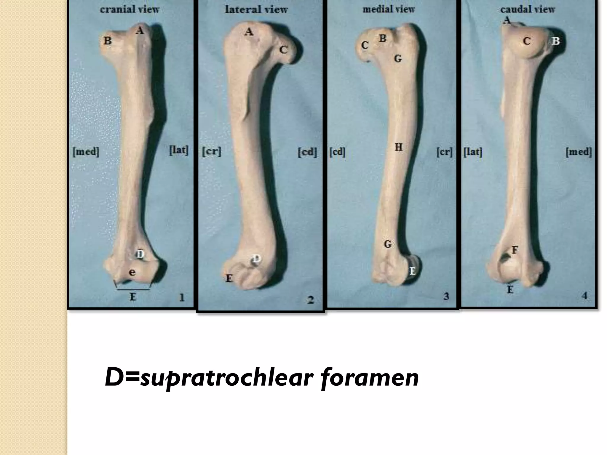 D=supratrochlear foramen

 