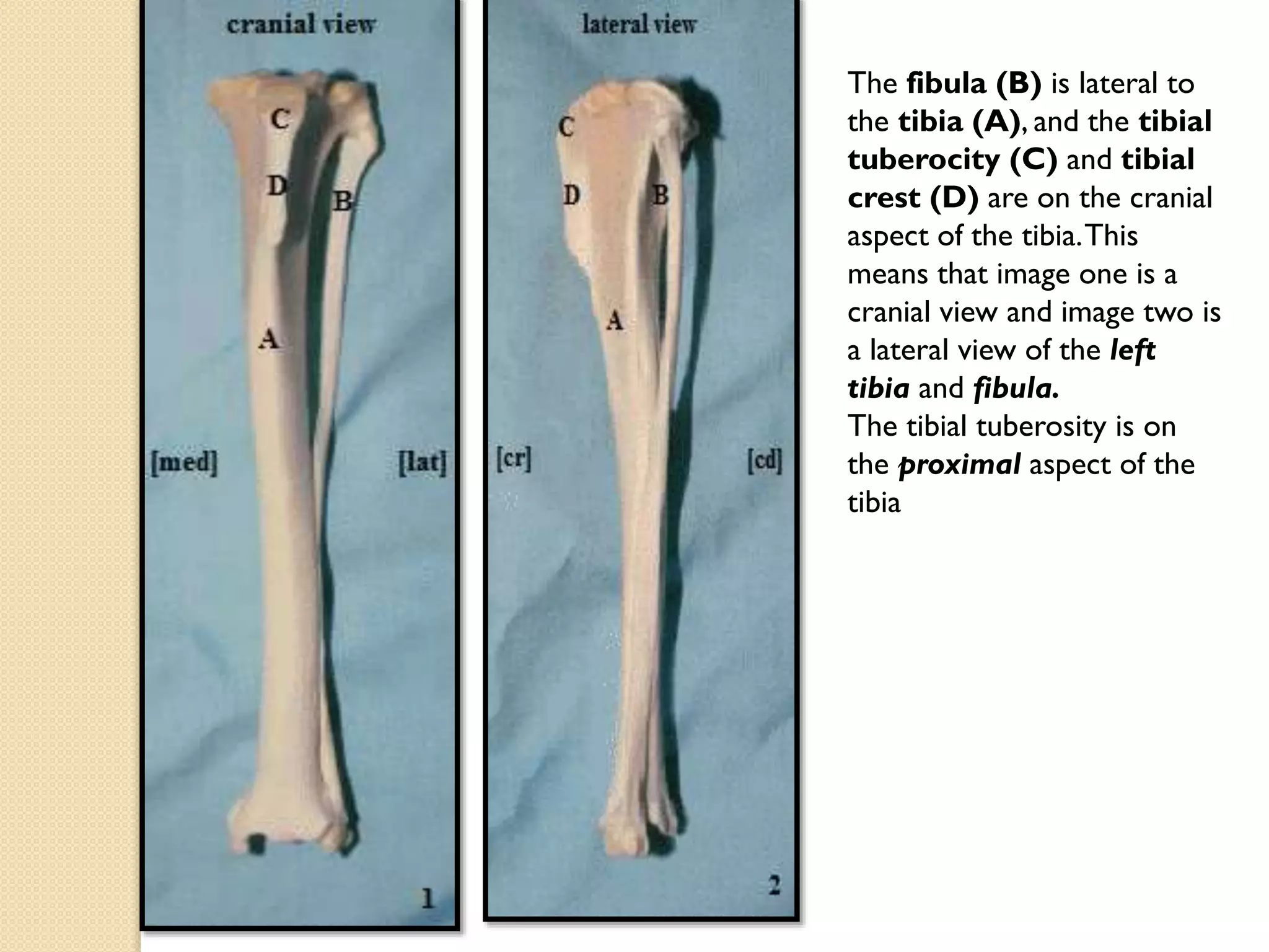 The fibula (B) is lateral to
the tibia (A), and the tibial
tuberocity (C) and tibial
crest (D) are on the cranial
aspect of the tibia. This
means that image one is a
cranial view and image two is
a lateral view of the left
tibia and fibula.
The tibial tuberosity is on
the proximal aspect of the
tibia

 