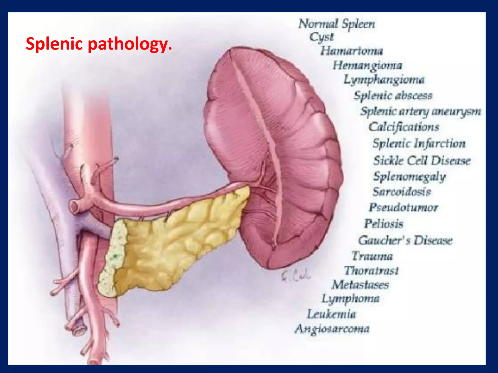 Splenic pathology.