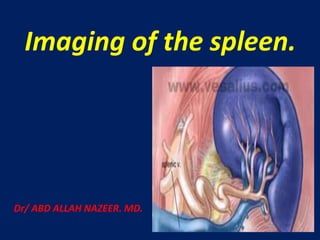 Imaging of the spleen.
Dr/ ABD ALLAH NAZEER. MD.
 