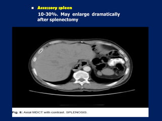  Accessory spleen
10-30%. May enlarge dramatically
after splenectomy
 