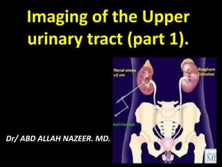 Dr/ ABD ALLAH NAZEER. MD.
Imaging of the Upper
urinary tract (part 1).
 