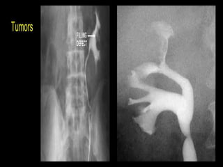 Presentation1.pptx, imaging of the urinary system. | PPTX