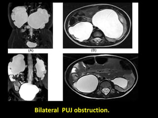 Presentation1.pptx, imaging of the urinary system. | PPTX