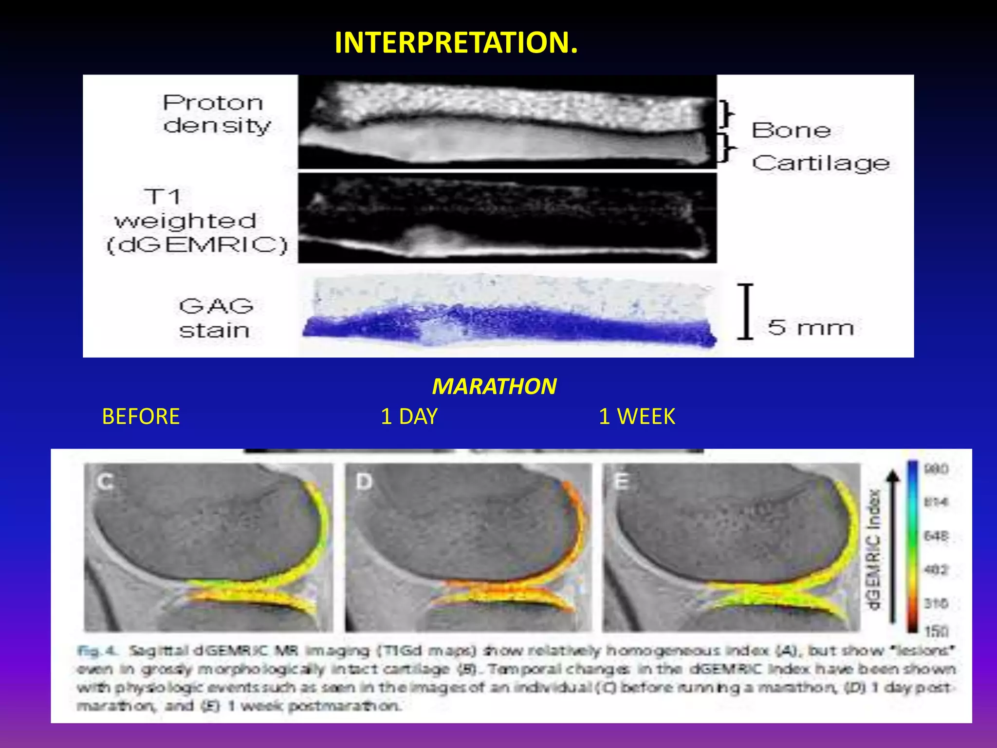 INTERPRETATION.
MARATHON
BEFORE 1 DAY 1 WEEK
 