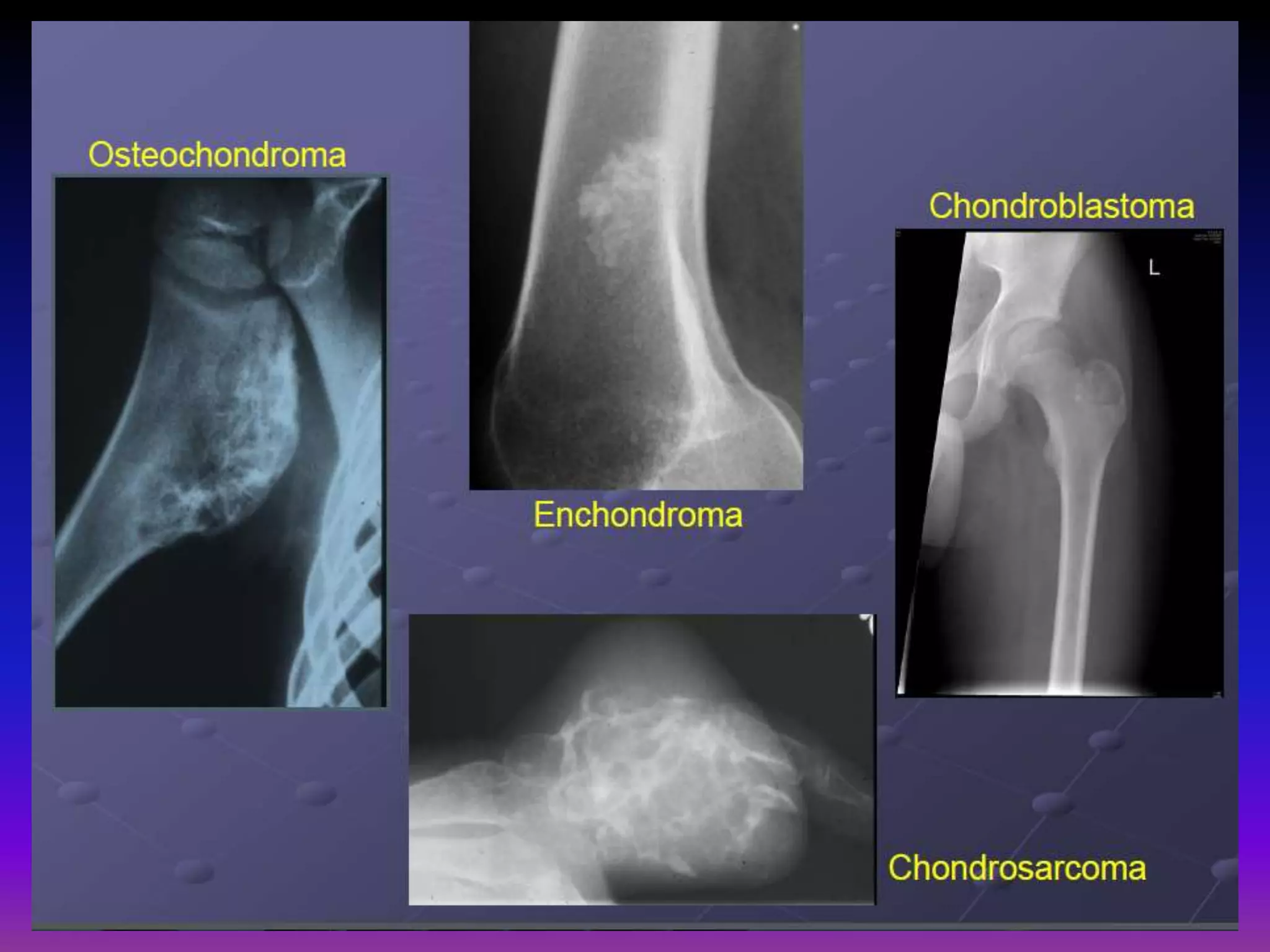 Presentation1.pptx. imaging of the cartilage.