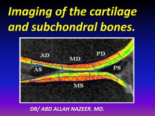 Imaging of the cartilage
and subchondral bones.
DR/ ABD ALLAH NAZEER. MD.
 