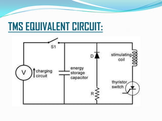 TMS EQUIVALENT CIRCUIT:
 