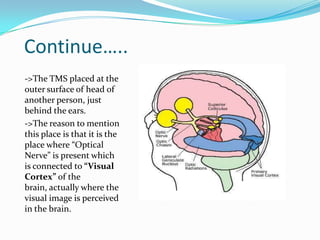 Continue…..
->The TMS placed at the
outer surface of head of
another person, just
behind the ears.
->The reason to mention
this place is that it is the
place where “Optical
Nerve” is present which
is connected to “Visual
Cortex” of the
brain, actually where the
visual image is perceived
in the brain.
 