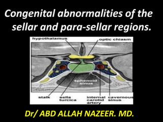 Congenital abnormalities of the
sellar and para-sellar regions.
Dr/ ABD ALLAH NAZEER. MD.
 