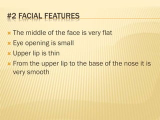 #2 FACIAL FEATURES
 The middle of the face is very flat
 Eye opening is small
 Upper lip is thin
 From the upper lip to the base of the nose it is
very smooth
 