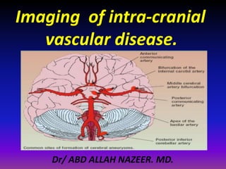 Imaging of intra-cranial
vascular disease.
Dr/ ABD ALLAH NAZEER. MD.
 