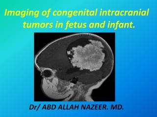 Imaging of congenital intracranial
tumors in fetus and infant.
Dr/ ABD ALLAH NAZEER. MD.
 