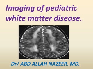 Imaging of pediatric
white matter disease.
Dr/ ABD ALLAH NAZEER. MD.
 