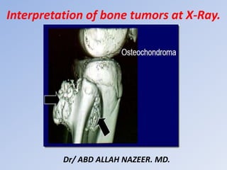 Interpretation of bone tumors at X-Ray.
Dr/ ABD ALLAH NAZEER. MD.
 