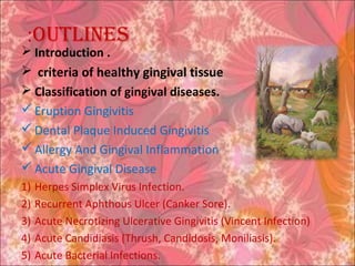 ouTlines:
 Introduction .
 criteria of healthy gingival tissue
 Classification of gingival diseases.
 Eruption Gingivitis
 Dental Plaque Induced Gingivitis
 Allergy And Gingival Inflammation
 Acute Gingival Disease
1) Herpes Simplex Virus Infection.
2) Recurrent Aphthous Ulcer (Canker Sore).
3) Acute Necrotizing Ulcerative Gingivitis (Vincent Infection)
4) Acute Candidiasis (Thrush, Candidosis, Moniliasis).
5) Acute Bacterial Infections.
 
