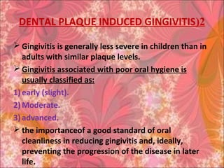 2(DENTAL PLAQUE INDUCED GINGIVITIS
 Gingivitis is generally less severe in children than in
adults with similar plaque levels.
 Gingivitis associated with poor oral hygiene is
usually classified as:
1)early (slight).
2)Moderate.
3)advanced.
 the importanceof a good standard of oral
cleanliness in reducing gingivitis and, ideally,
preventing the progression of the disease in later
life.
 